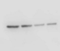 TKL1 | transketolase (chloroplastic) in the group Antibodies Plant/Algal  / Developmental Biology / Ion metabolism at Agrisera AB (Antibodies for research) (AS15 2903)